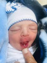 نوزاد عراقی با دندان به دنیا آمد