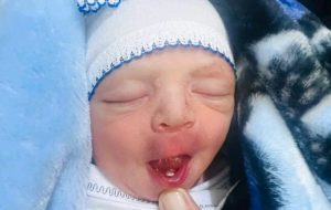 نوزاد عراقی با دندان به دنیا آمد