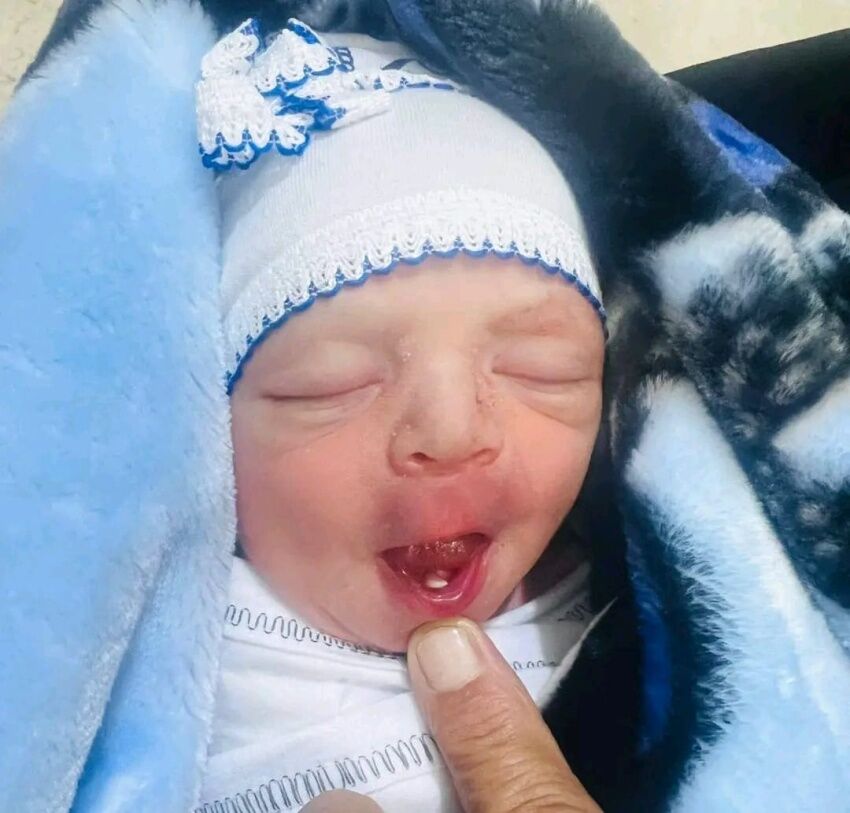 نوزاد عراقی با دندان به دنیا آمد نوزاد عراقی با دندان به دنیا آمد