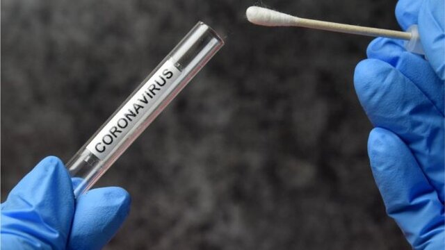 تست PCR قابلاعتمادتر است یا نتیجه سیتیاسکن؟ تست PCR قابلاعتمادتر است یا نتیجه سیتیاسکن؟