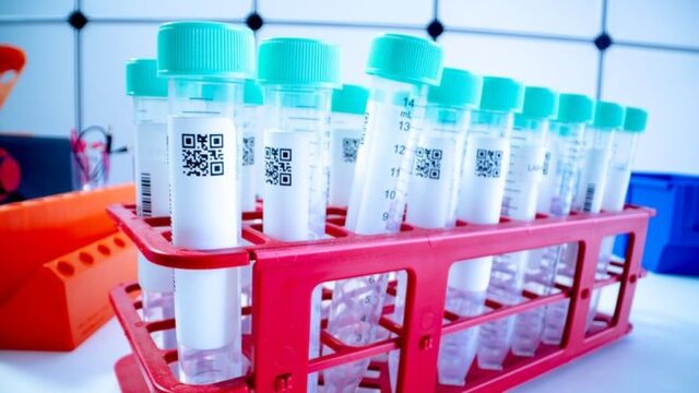 کیتهای تشخیصی فعلی، ویروس جهش یافته کرونا را شناسایی میکنند کیتهای تشخیصی فعلی، ویروس جهش یافته کرونا را شناسایی میکنند