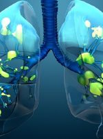 کشف یک واکنش سلولی غیرمنتظره در ریه افراد مبتلا به کووید-۱۹