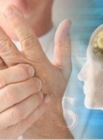 وجود ۷۰ هزار مبتلا به ام‌اس در ایران/ افزایش شیوع بیماری در مناطق شهری کشور