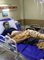 کاهش محسوس بیماران کرونایی در بیمارستان های مازندران