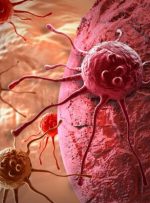 نظارت مجلس بر نحوه اجرای قانون پیشگیری از سرطان‌های شایع زنان